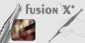 FusionEx